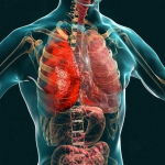 Peradangan paru-paru kronis terlihat pada ilustrasi organ pernapasan manusia